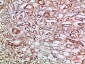 Tetranectin Polyclonal Antibody